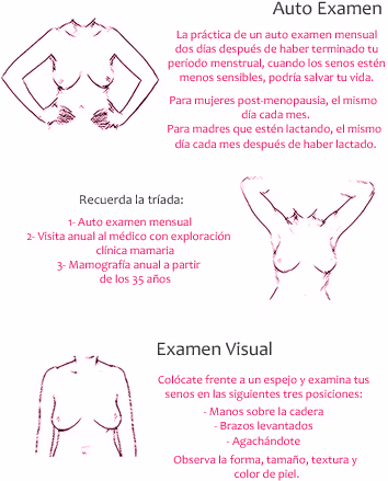 Examen de las mamas por si hay nódulos o bultos